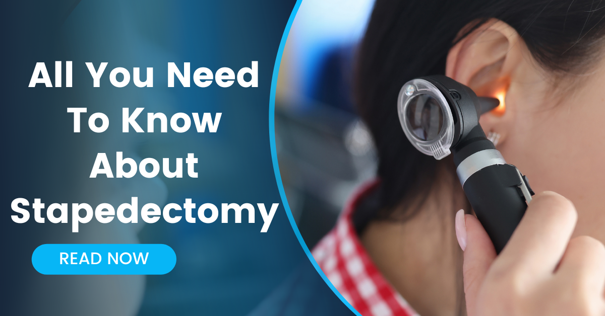 All You Need To Know About Stapedectomy
